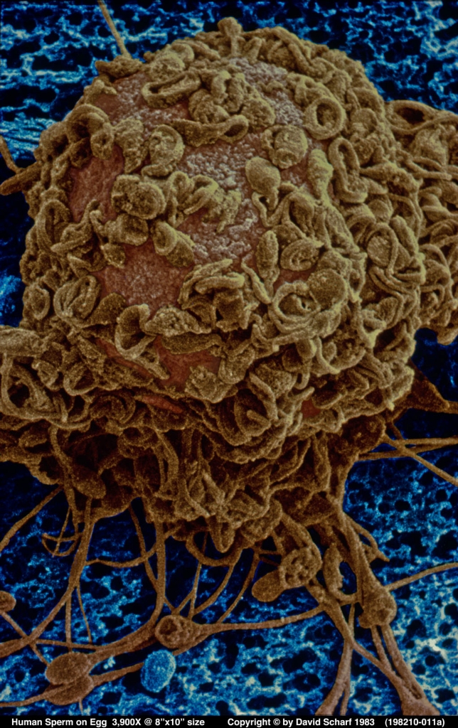 198210-011a-Sperm-on-Egg1