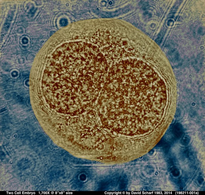 198211-001a-Two-Cell-Embryo1