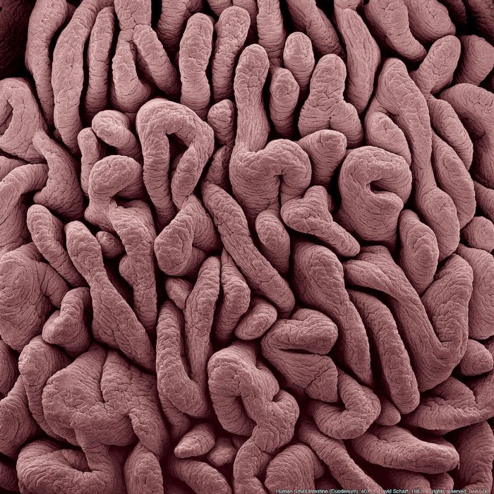198705-001a-Duodenum1