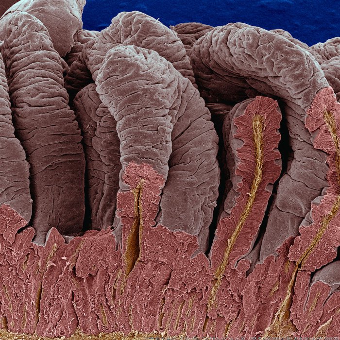 198705-028a-Duodenum1
