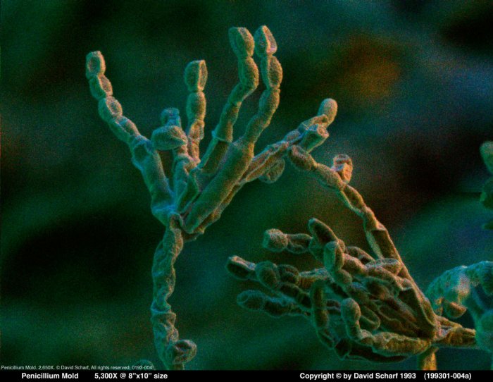 199301-004a-Penicillium1