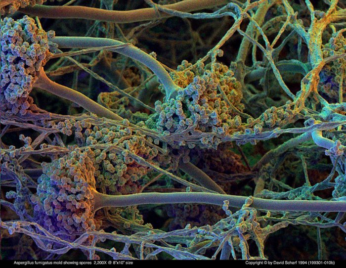 199301-010b-Aspergillus-fum