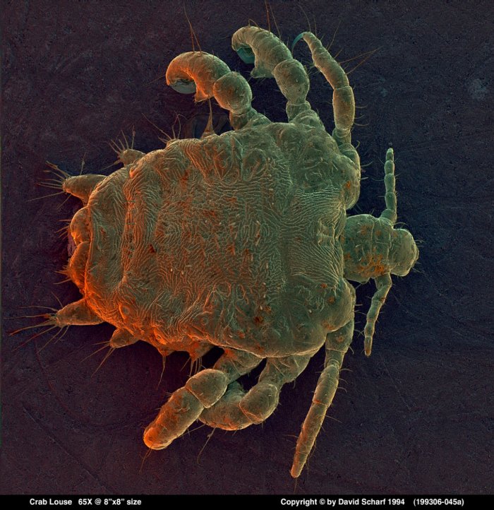 199306-045a-Crab-Louse1