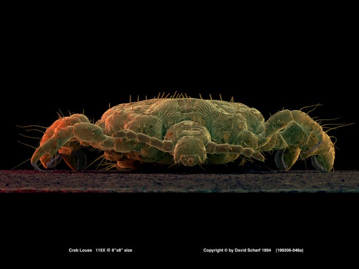 199306-046a-Crab-Louse1
