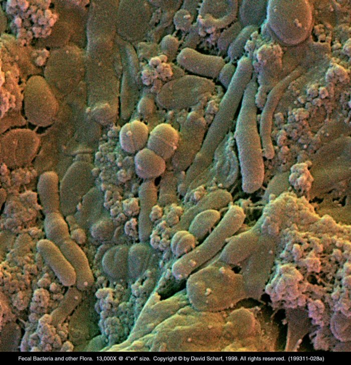 199311-028a-Fecal-Microbes1