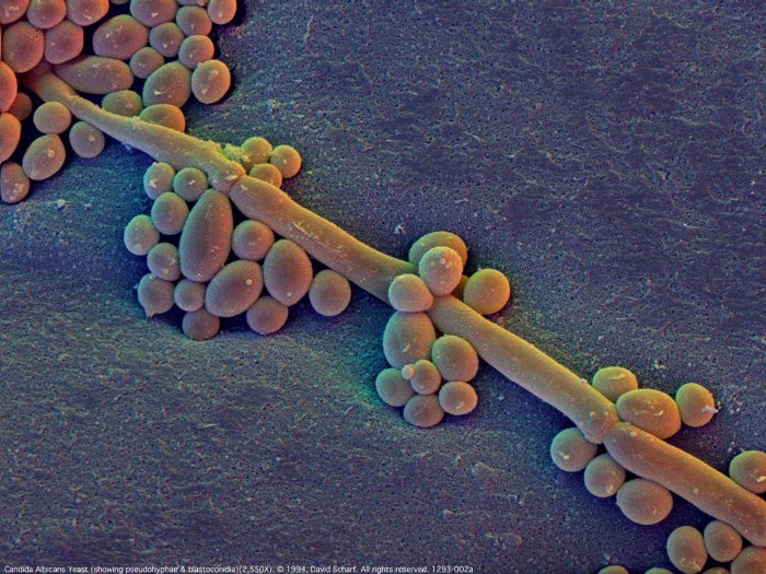 199312-002a-Candida-albican-Yst1