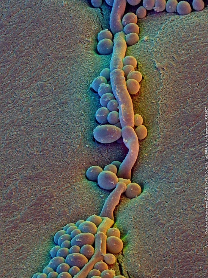 199312-007a Candida Yeast