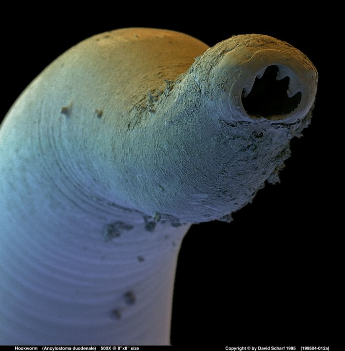 199504-012a Hookworm A