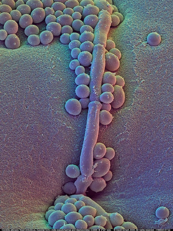 199602-011a-Candida-albicans1