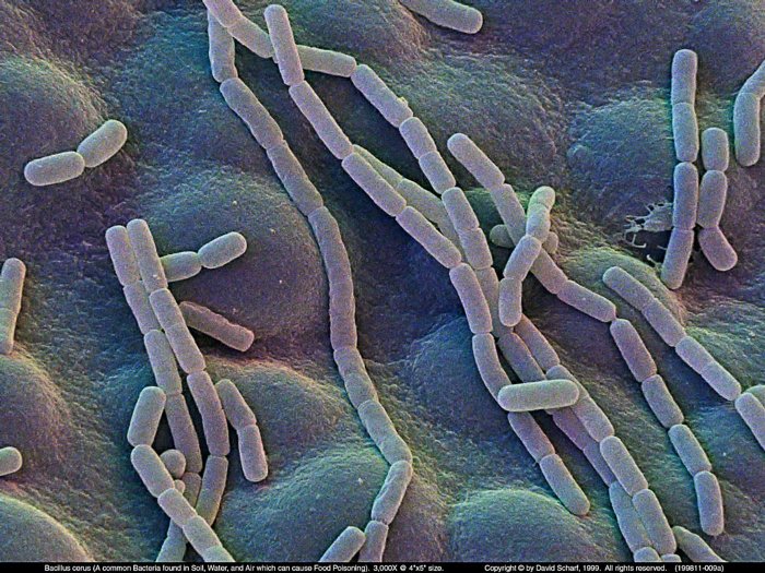 199811-009a-Bacillus-cerus1
