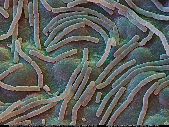 199811-010a-Bacillus-cerus1