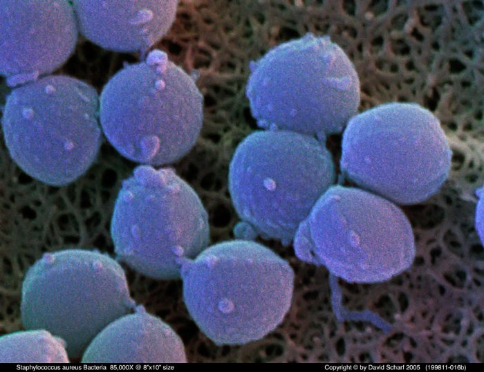 199811-016b-Staph-aureus1