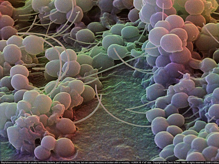 199812-020a-Staphylococcus-E1