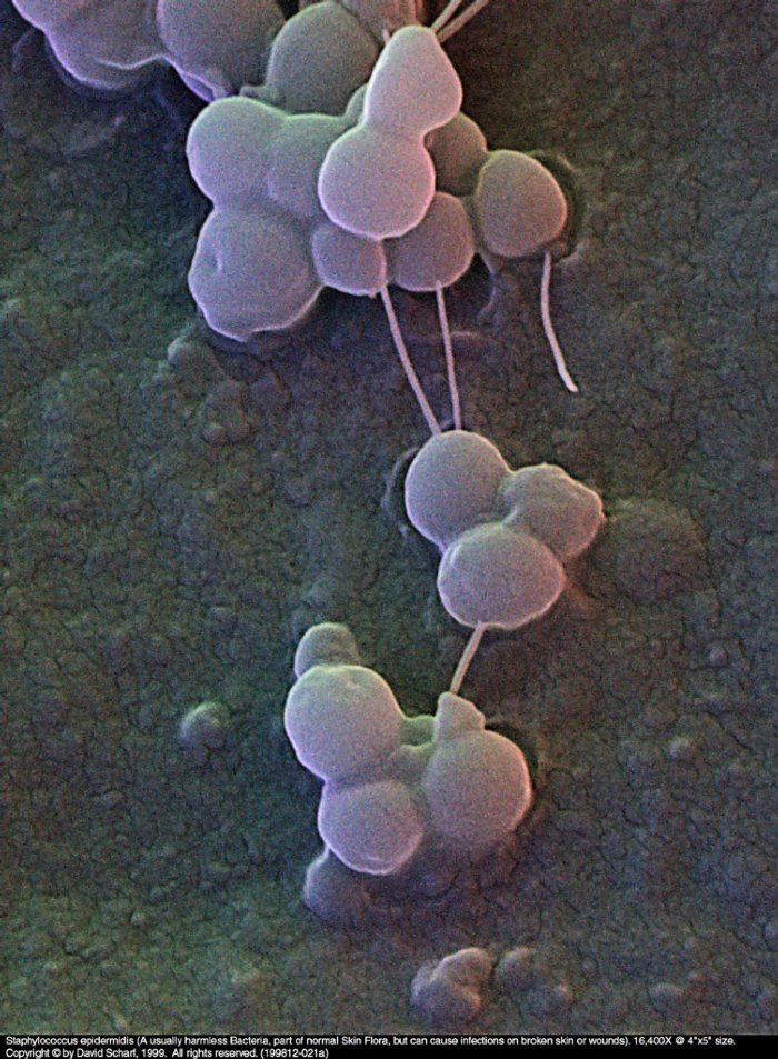 199812-021a-Staphylococcus-E1