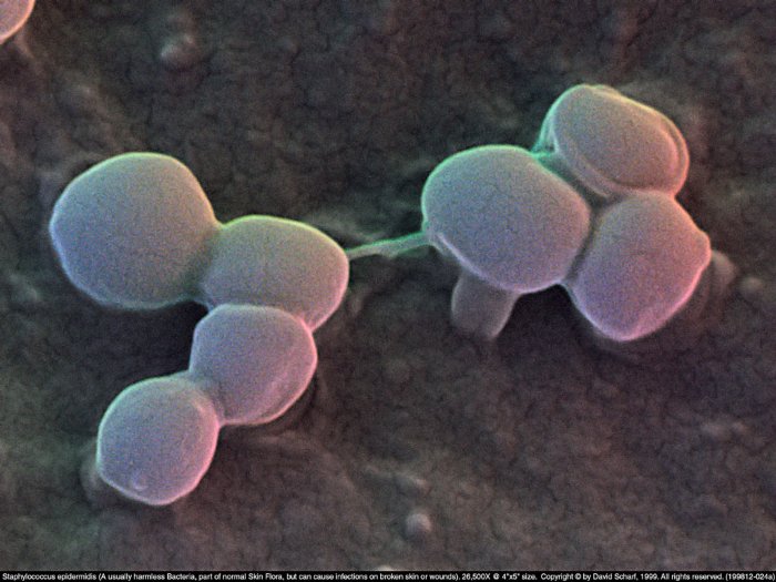199812-024a-Staphylococcus-E1