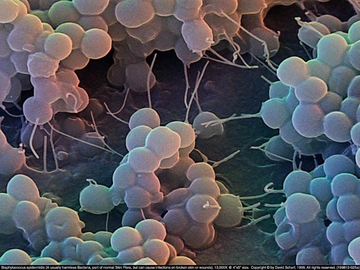 199812-025a-Staphylococcus-E1