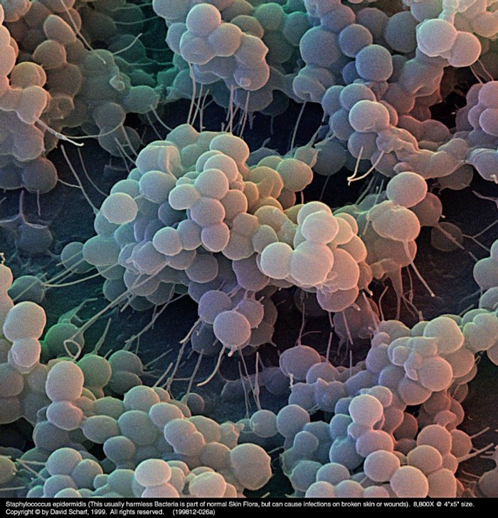 199812-026a-Staphylococcus-E1