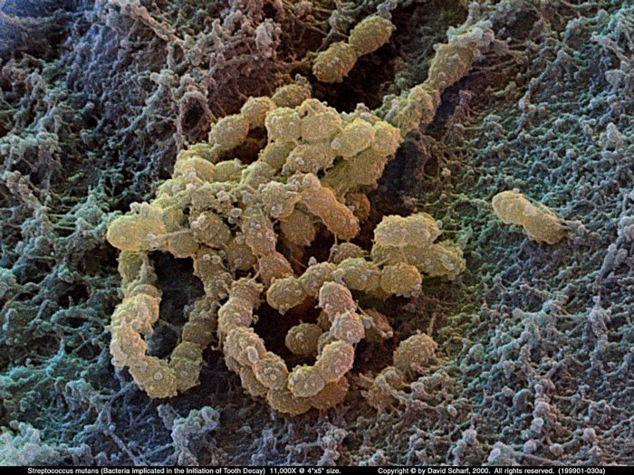 199901-030a-Streptococcus-mutan1