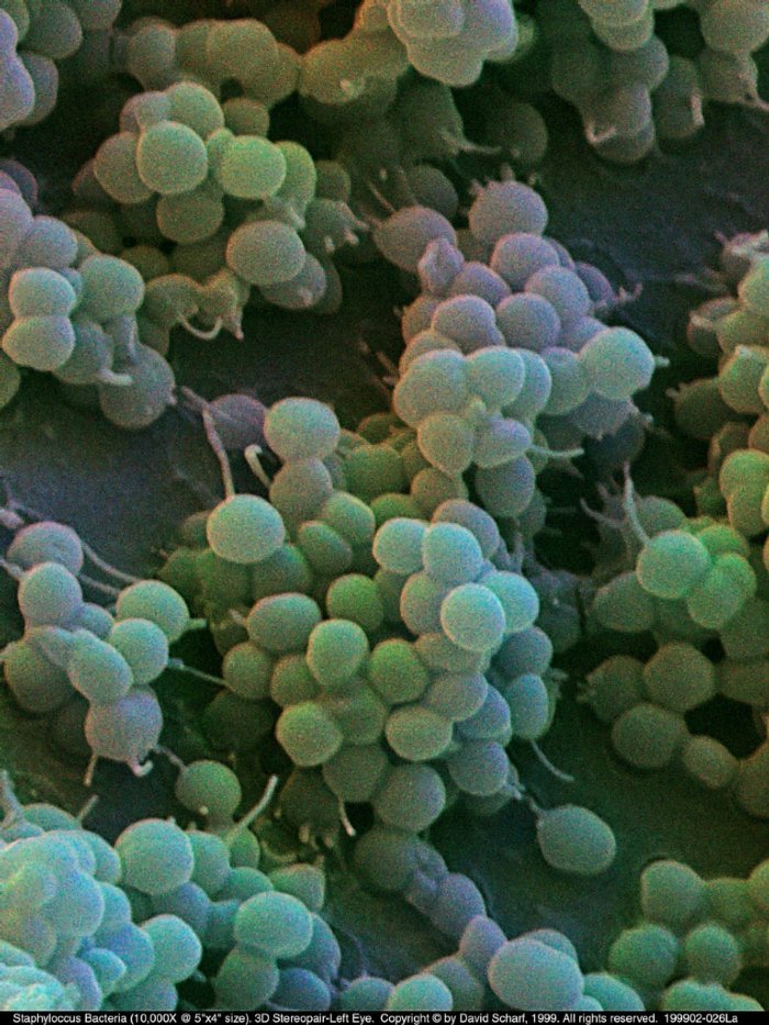 199902-026La-Staphylococcus-3D1