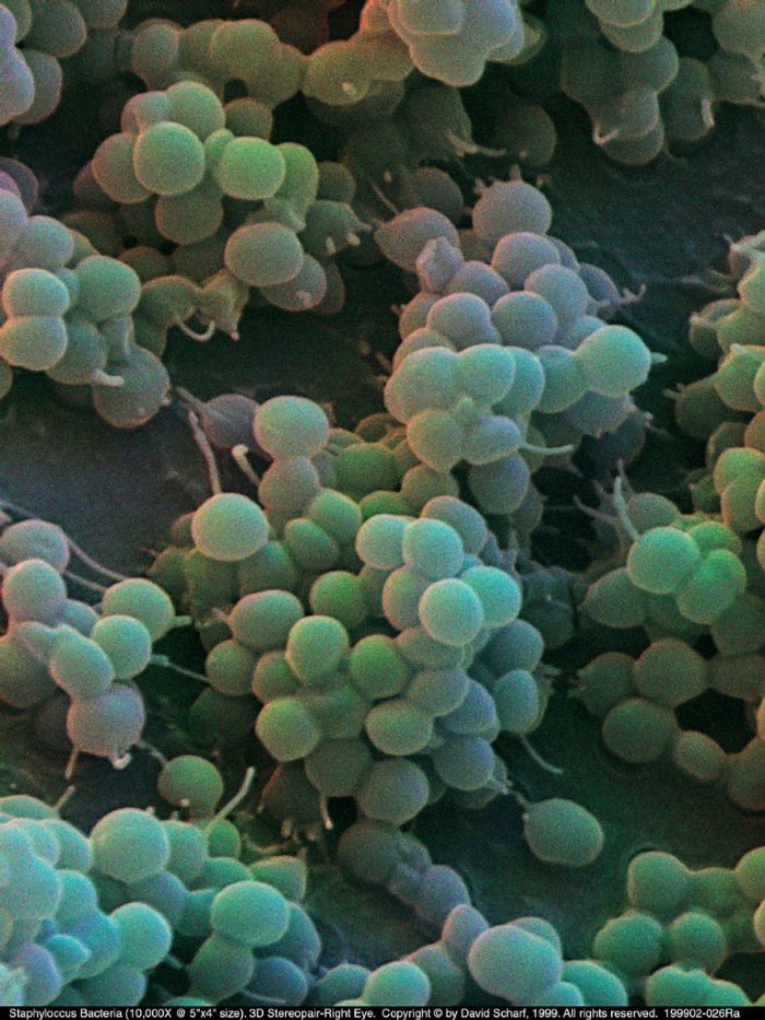 199902-026Ra-Staphylococcus-3D1