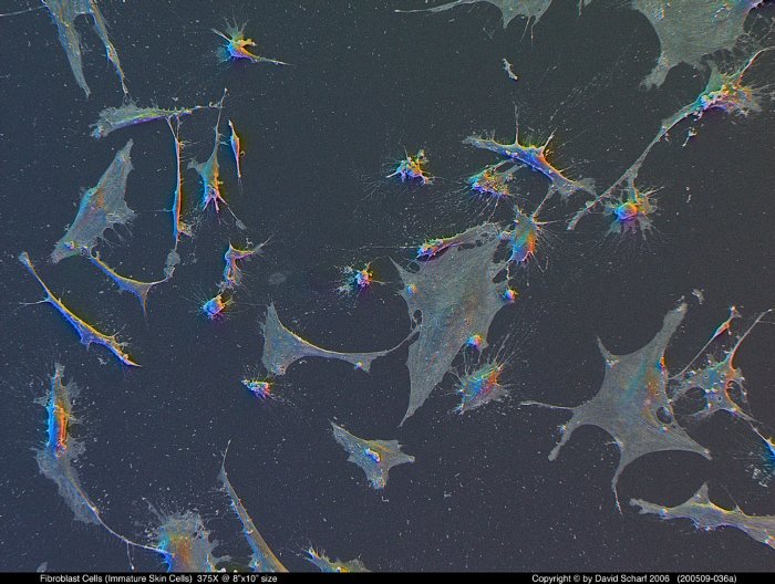 200509-036a-Fibroblast-Cells1