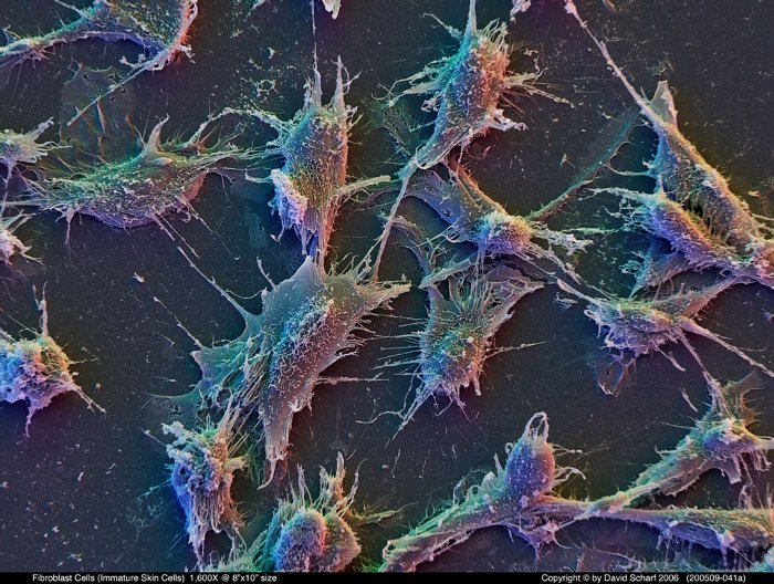 200509-041a-Fibroblast-Cells1