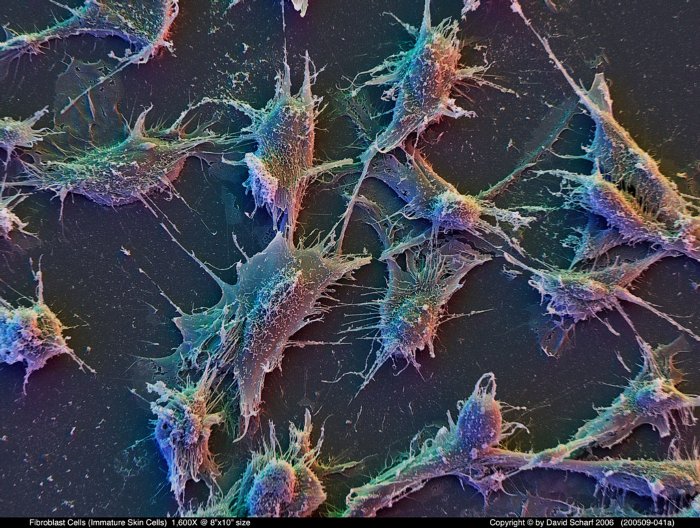 200509-041a-Fibroblast-Cells1