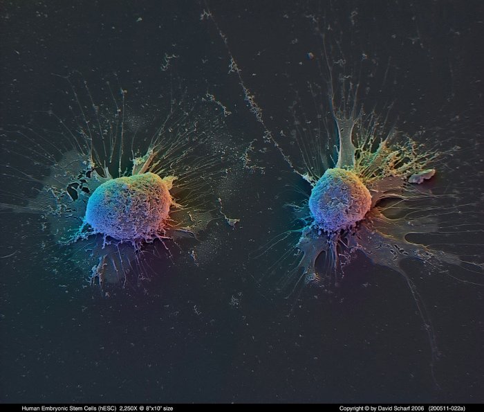 200511-022a-hES-Cells1