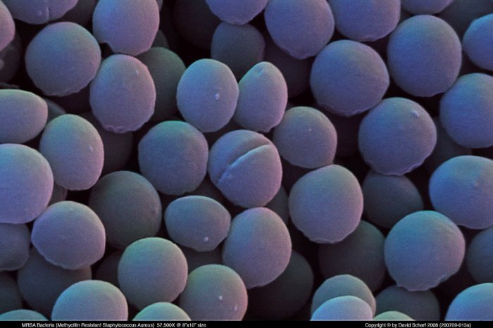 200709-013a-Staph-Aureus-MRSA1