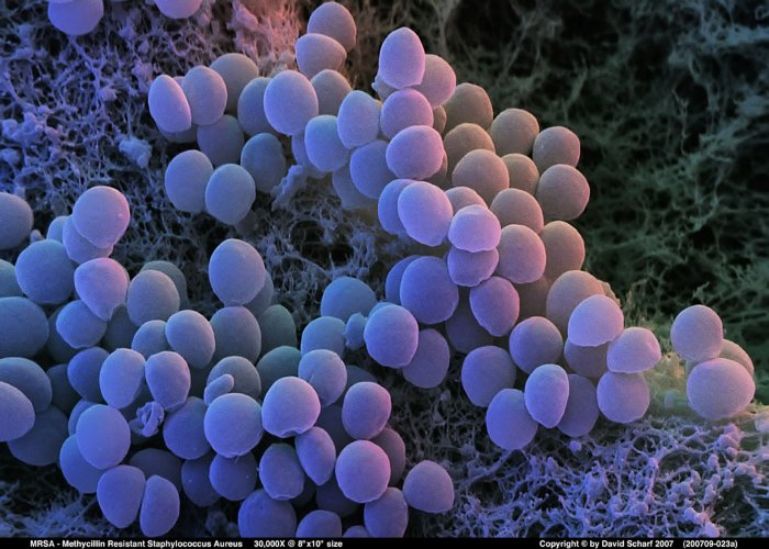 200709-023a-Staph-Aureus-MRSA1