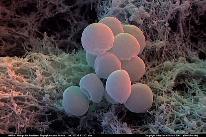 200709-026a-Staph-Aureus-MRSA1