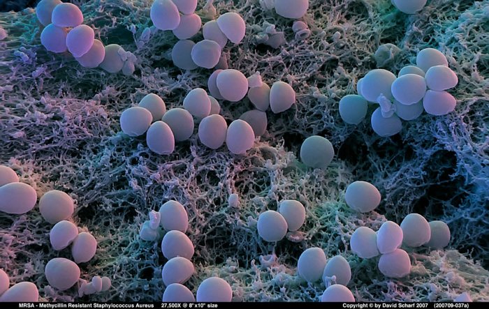 200709-037a-Staph-Aureus-MRSA1