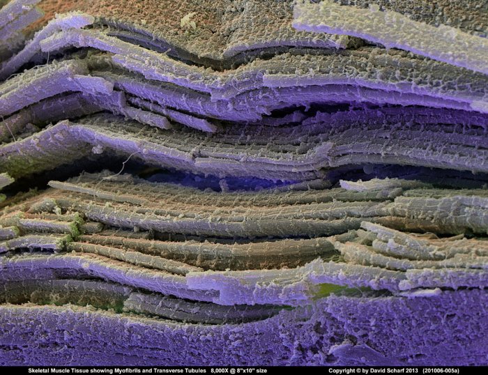 201006-005a-Muscle-Tissue1