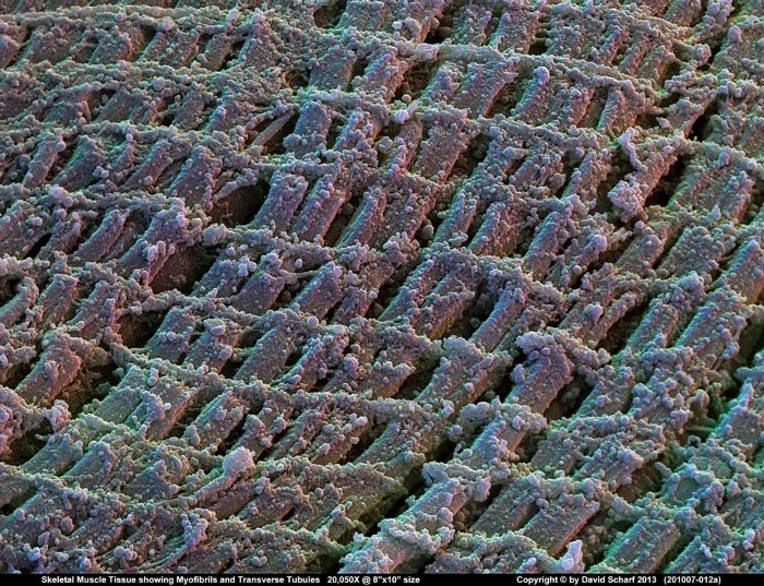 201007-012a-Muscle-Tissue1