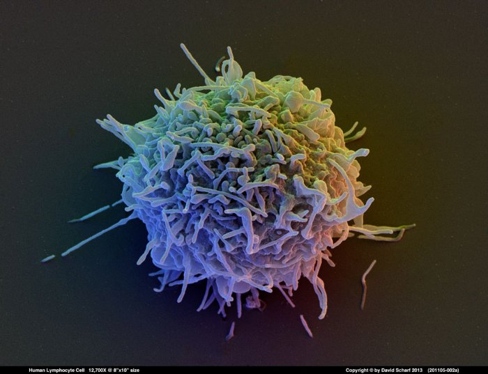 201105-002a-Lymphoblast-Cell1