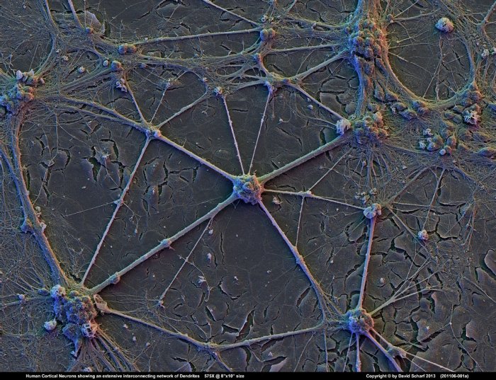 201106-001a-Neurons1