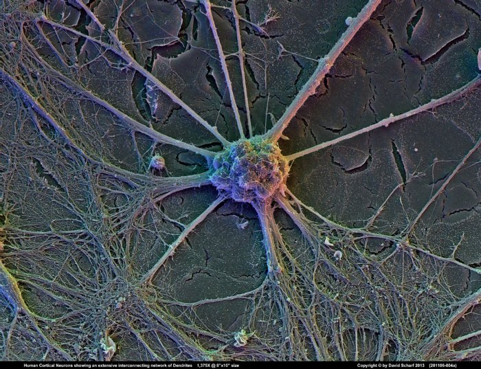 201106-004a-Neurons1