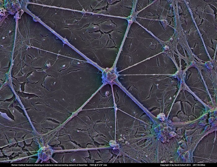 201106-005a-Neurons1