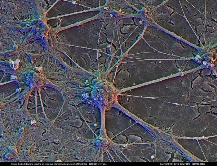 201106-008a-Neurons1