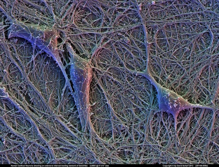 201106-009a-Neurons1
