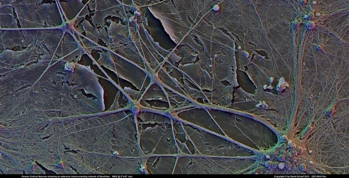 201106-015a-Neurons1