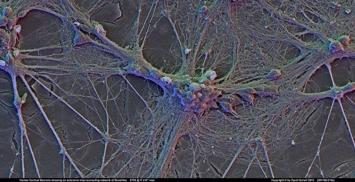 201106-016a-Neurons1