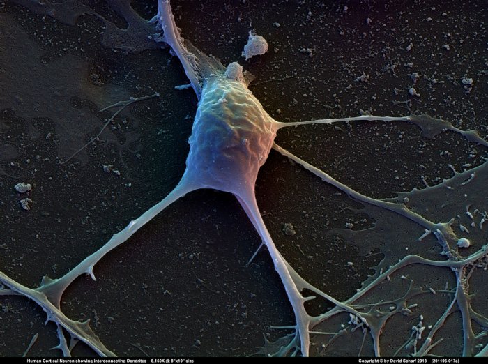 201106-017a-Neuron1