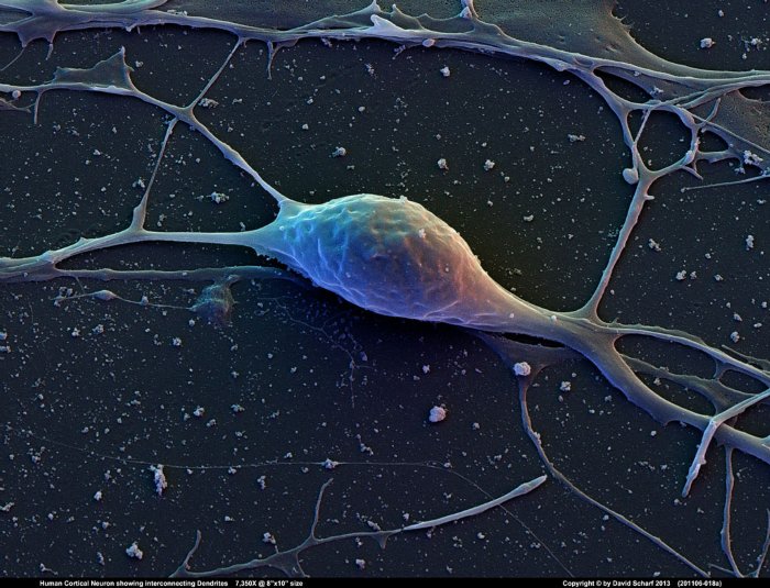 201106-018a-Neuron1