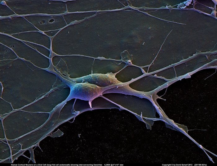 201106-021a-Neurons1