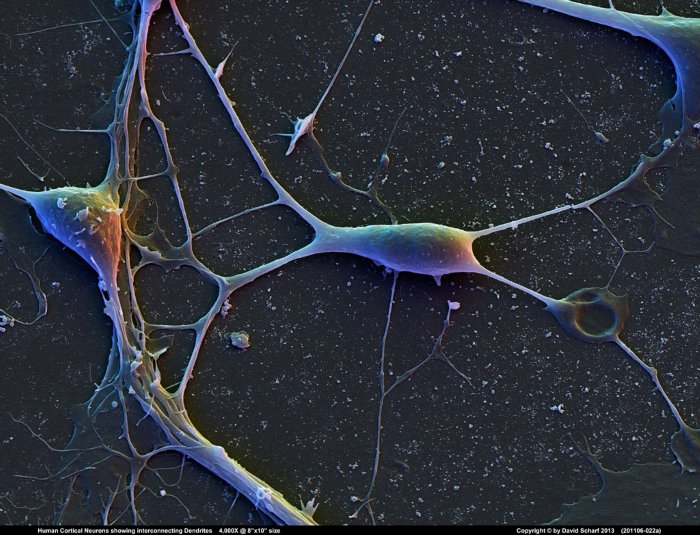 201106-022a-Neurons1