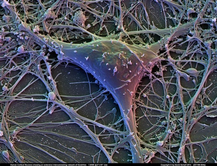 201106-024a-Neuron1