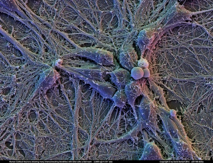 201106-025a-Neurons1