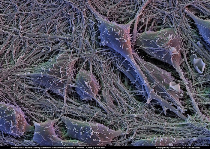 201106-026a-Neurons1