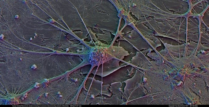 201106-028a-Neurons1